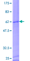 12.5% SDS-PAGE Stained with Coomassie Blue.